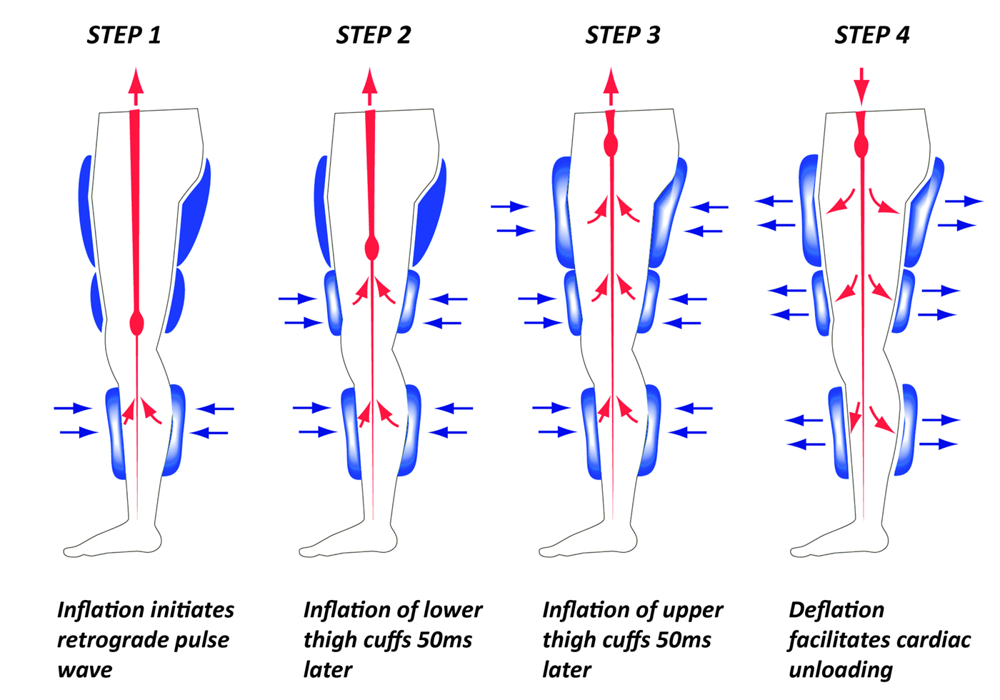 EECP Heart Blood Flow