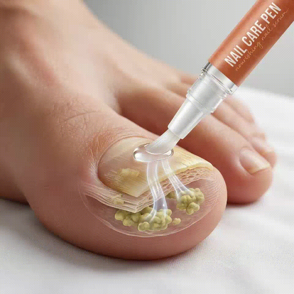 FungaBeam Pen Apllication method