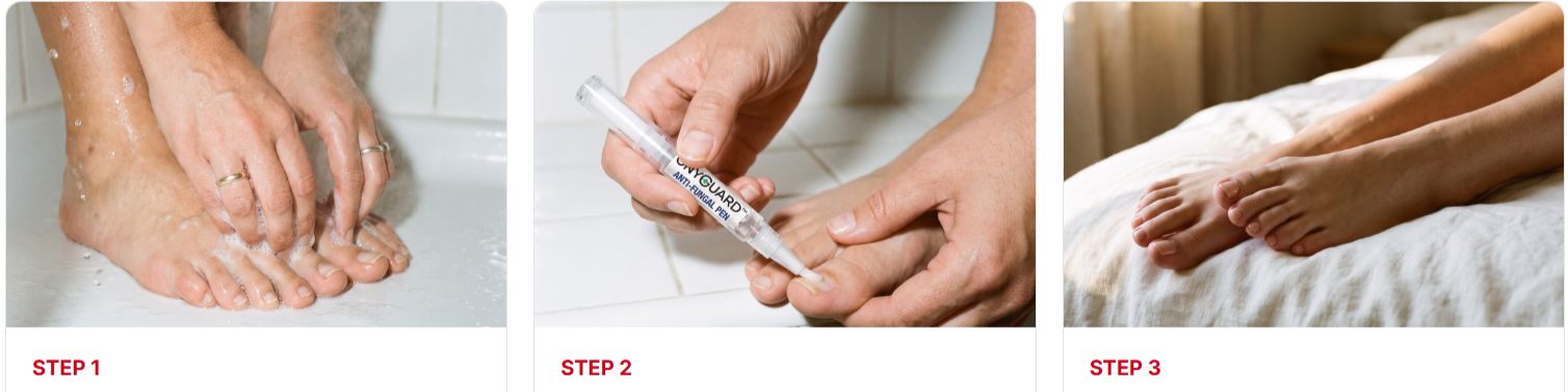 OnyGuard Nail Fungus Pen How to Use